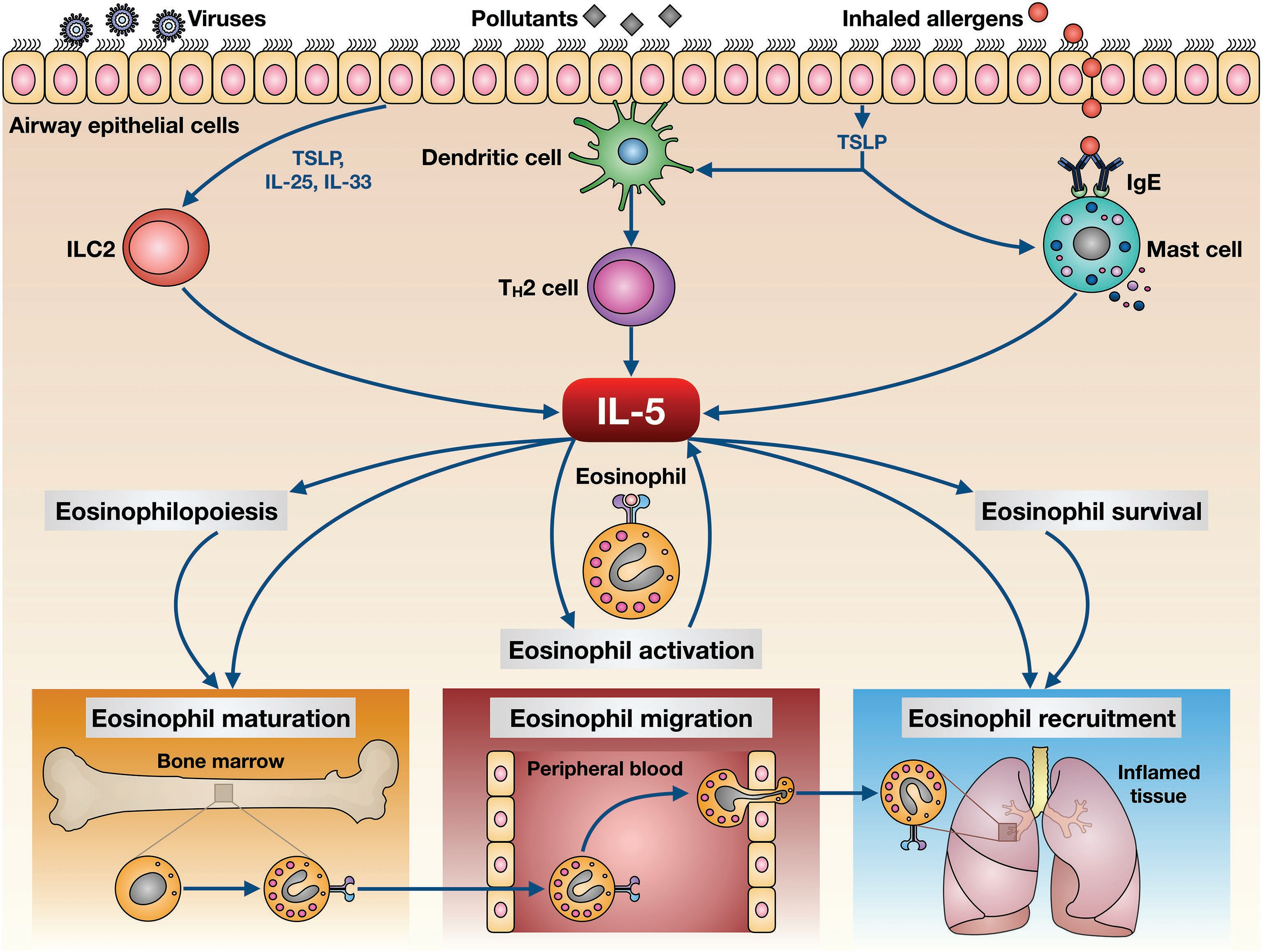 Eosinophilic inflammatory factor IL5