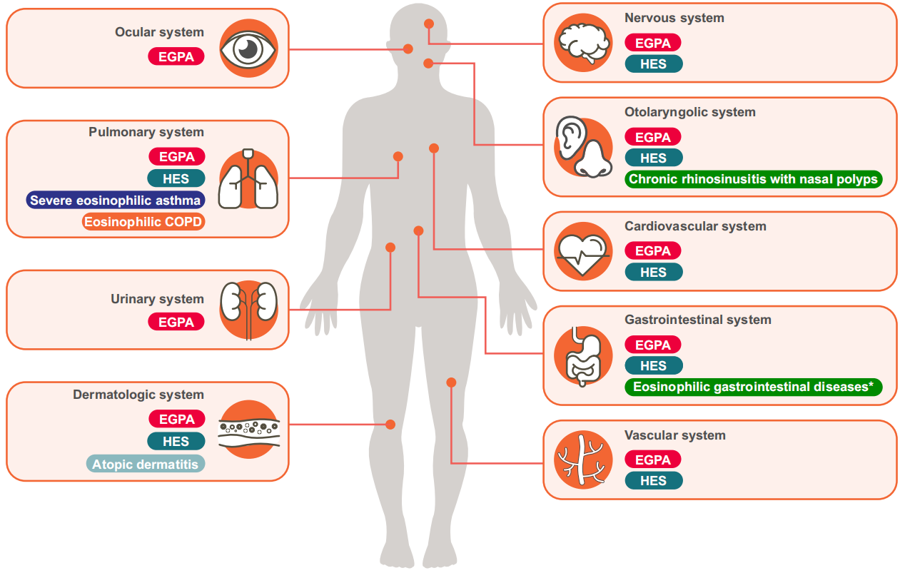 Eosinophilic inflammatory factor IL5